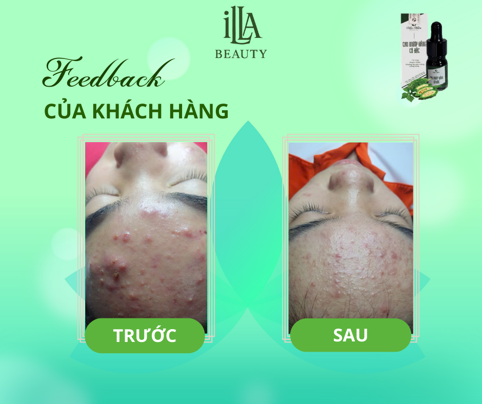 Hoạt động tại Lào Cai
